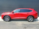 Used 2022 Acura MDX SH-AWD w/ Technology Package image 2