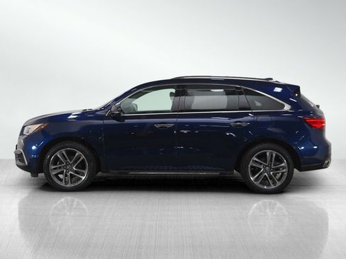 Used 2018 Acura MDX SH-AWD w/ Advance Package image 2