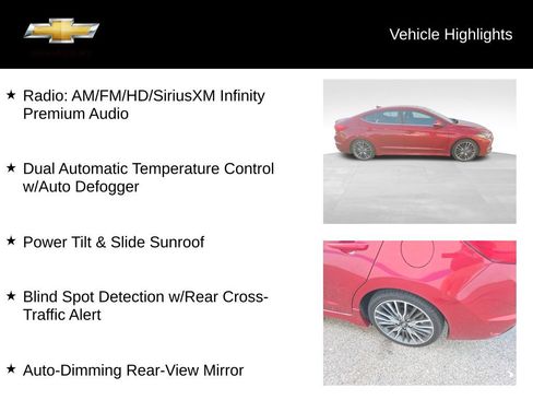 Used 2017 Hyundai Elantra Sport w/ Sport Premium Package 06 FWD image 19