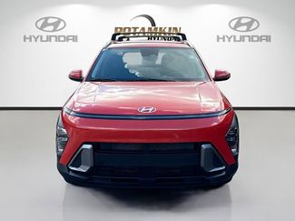 Used 2024 Hyundai Kona SEL video 2