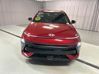 Used 2025 Hyundai Kona N Line S video 2
