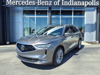 Used 2022 Acura MDX w/ Advance Package AWD/4WD video 1