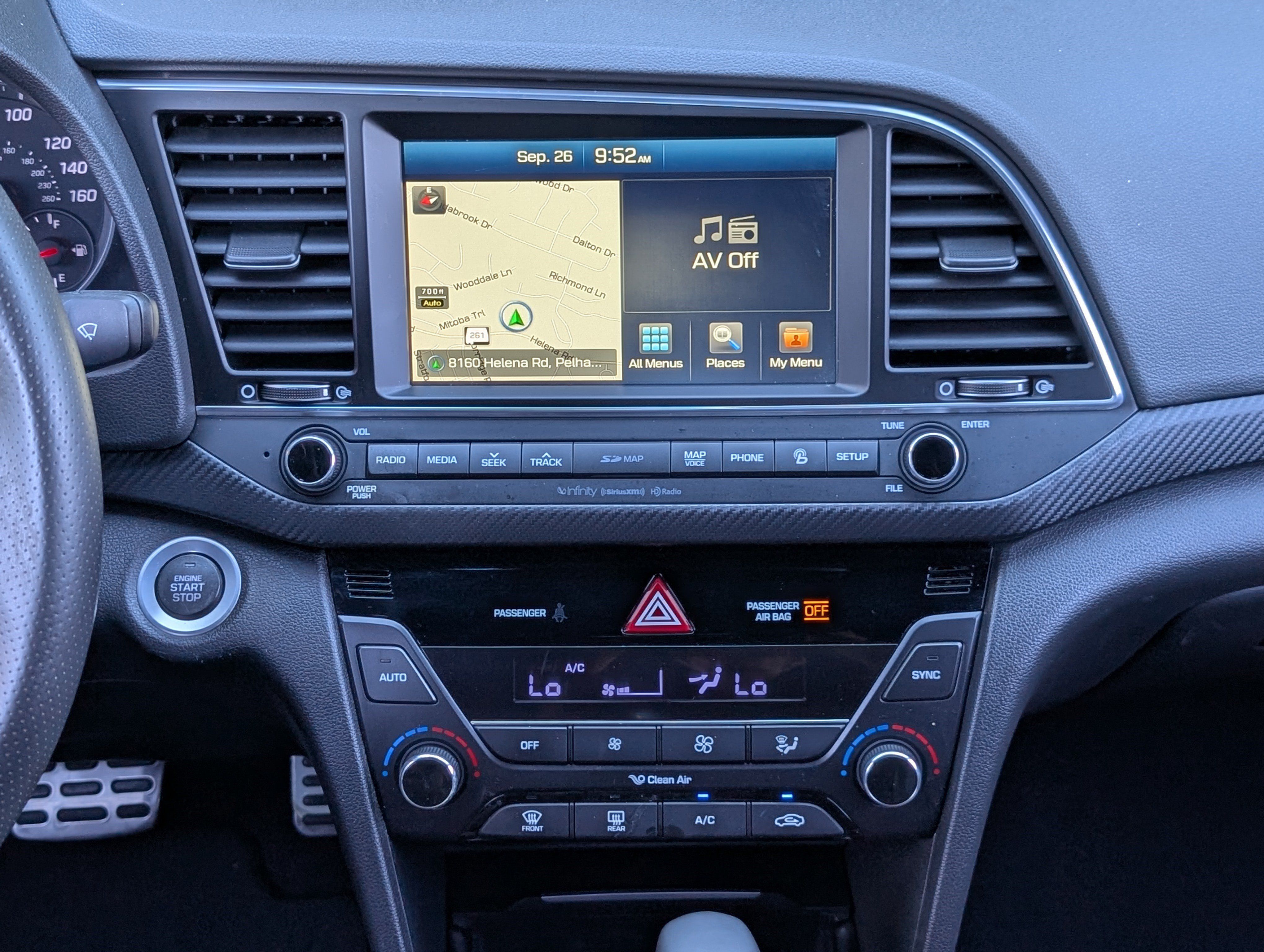 Used 2018 Hyundai Elantra Sport w/ Sport Premium Package 03 FWD image 25