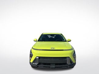 Used 2024 Hyundai Kona SE video 2