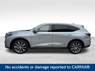 New 2026 Acura MDX SH-AWD w/ Technology Package video 2