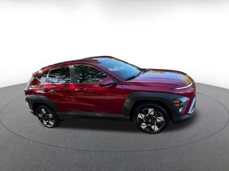 Used 2025 Hyundai Kona SEL video 2