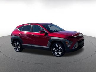 Used 2025 Hyundai Kona SEL video 2