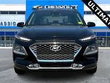 Used 2021 Hyundai Kona Ultimate image 2