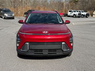 Used 2025 Hyundai Kona SEL video 2