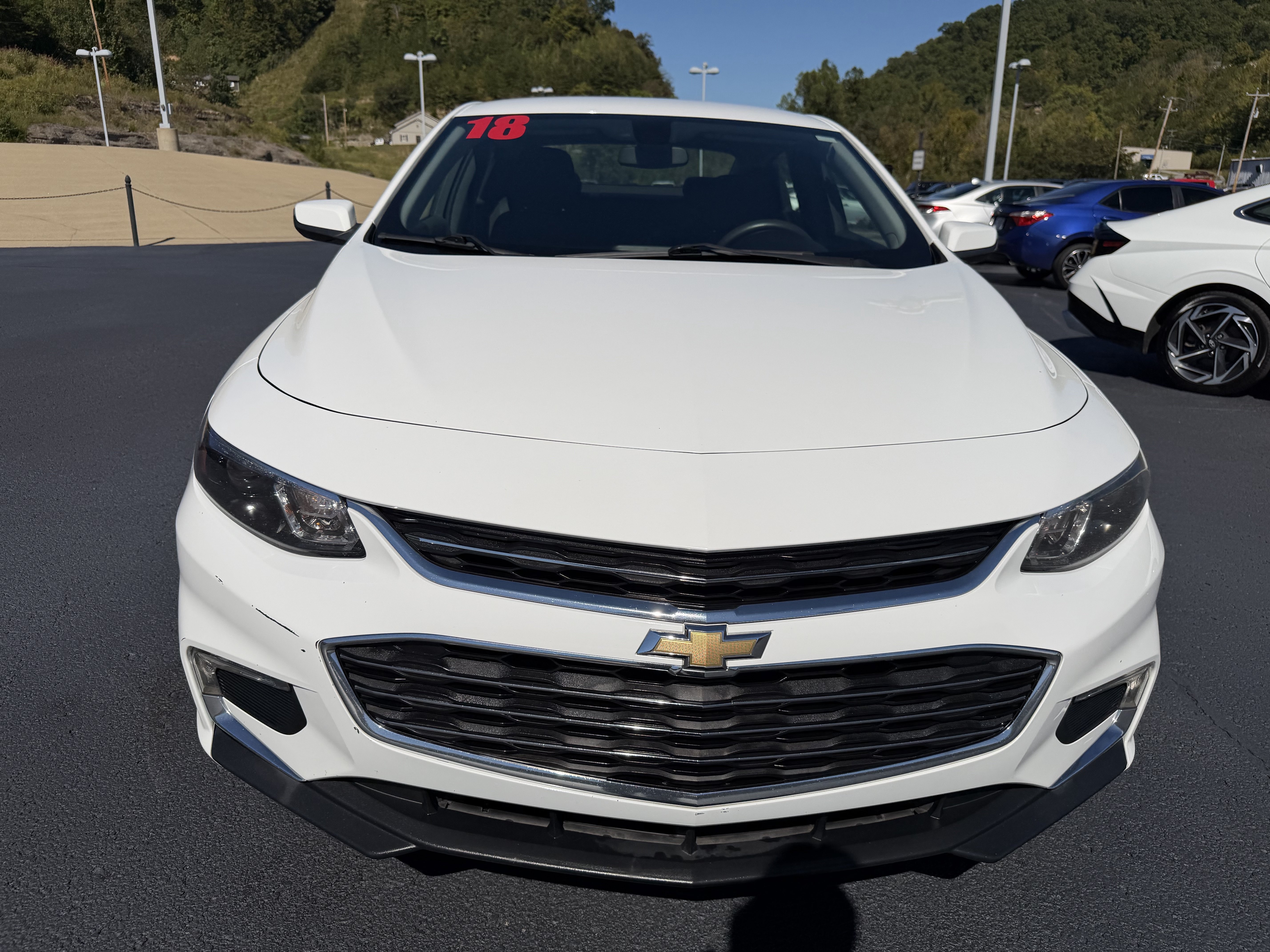 Used 2018 Chevrolet Malibu LT FWD image 2